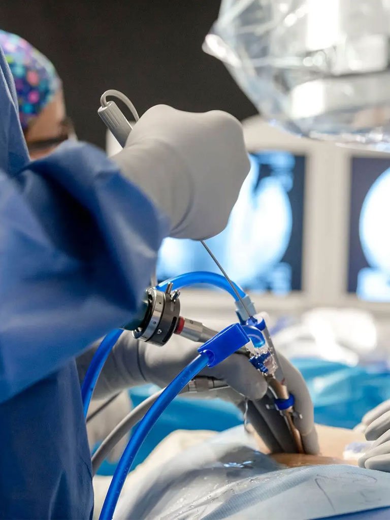 Percutaneous / Awake Procedures
